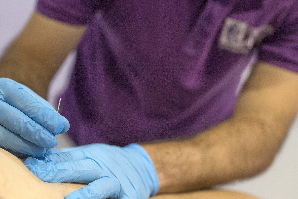 fisioterapia_adal_alcorcon_puncion_seca_movil Fisioterapia Adal Alcorcón