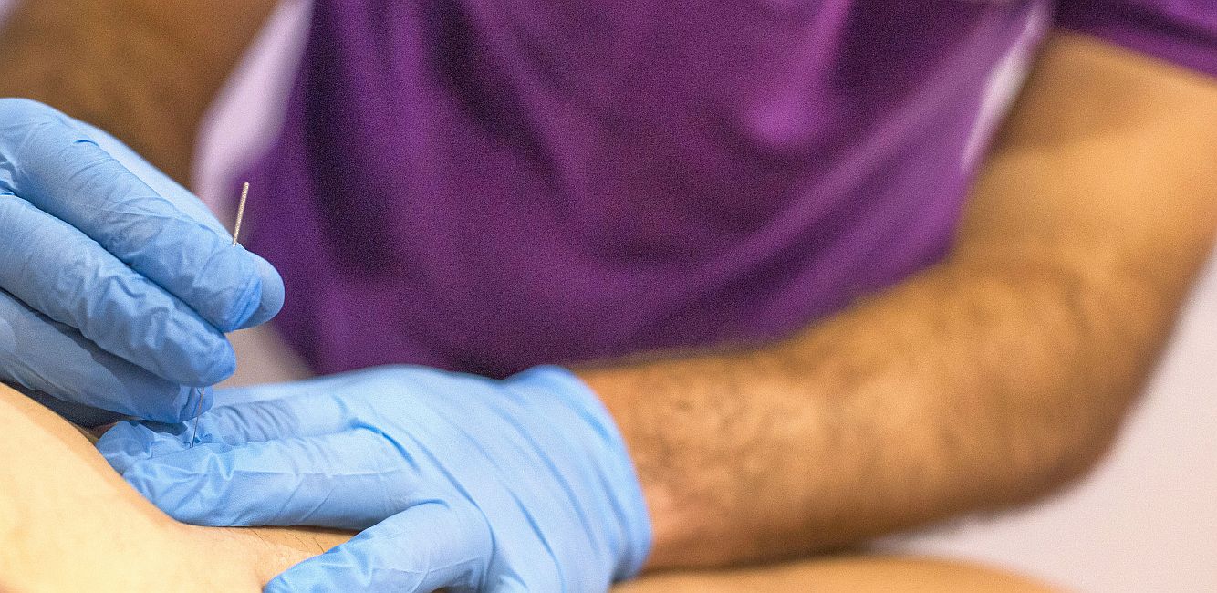 fisioterapia_adal_puncion_seca Fisioterapia Adal Alcorcón