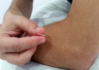 Fisioterapia Adal Alcorcón